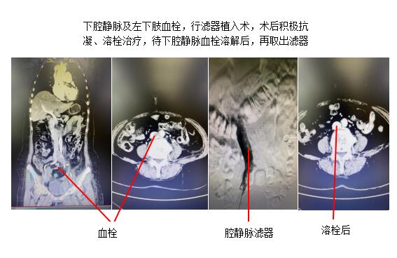 QQ截图20200810083534